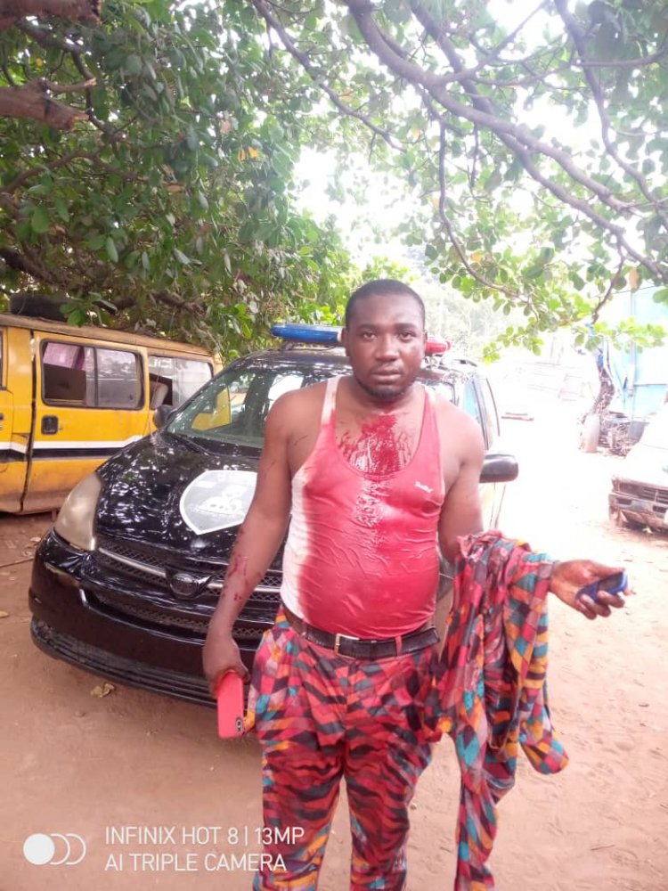 In Anambra, Amansea Prince Narrowly Escapes Death After Bloody Attack 