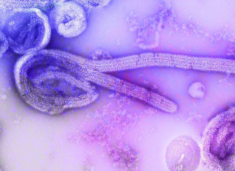 Ebola might be a chronic infection – but here's why we shouldn't panic